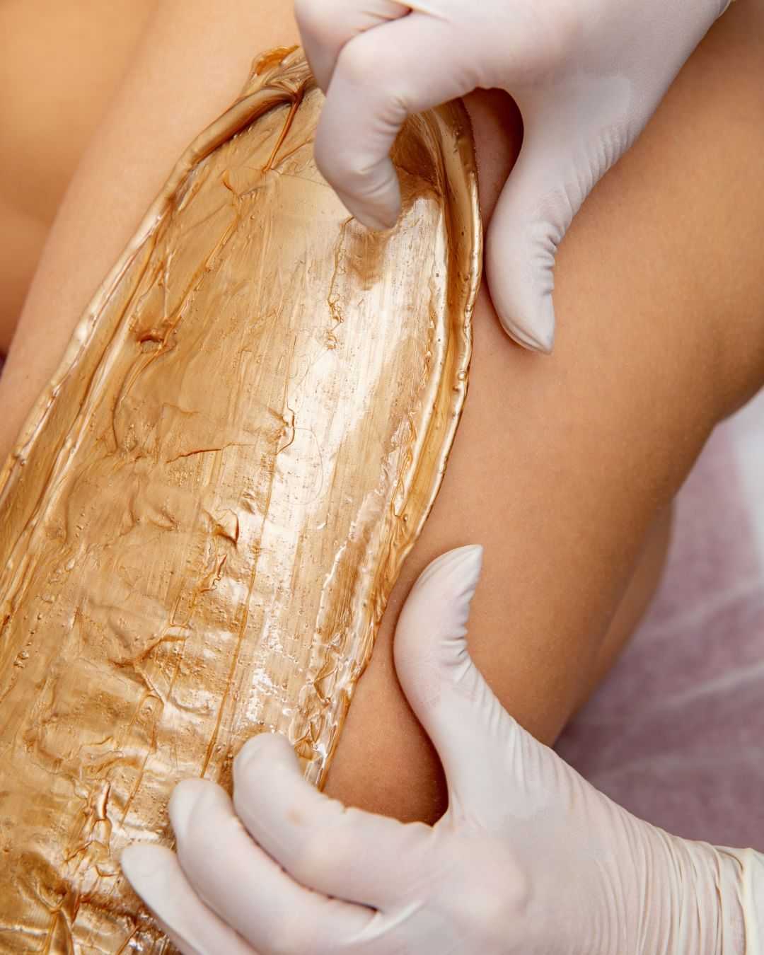 Person's legs receiving a sugaring hair removal treatment with caramel-colored paste.