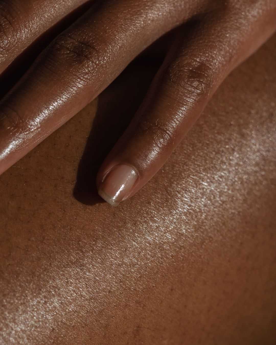 Close-up of a hand with glossy skin resting gently on another person's skin.